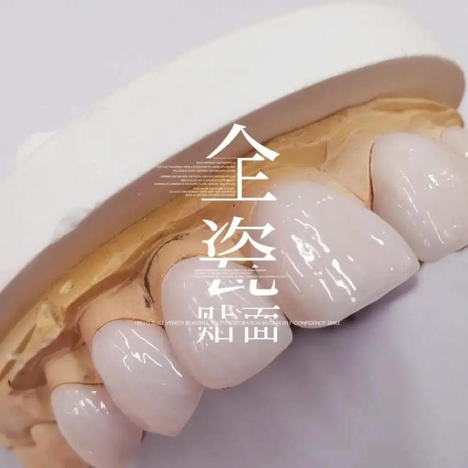 k8凯发牙齿贴面制备视频牙齿美白冷光美白值不值得做美伦美咖瓷贴面是不是很贵？能保
